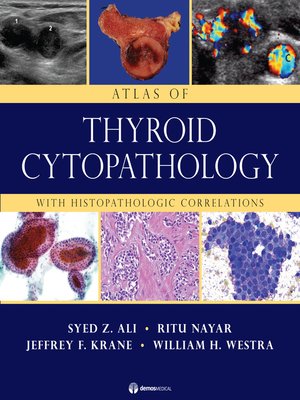 cover image of Atlas of Thyroid Cytopathology